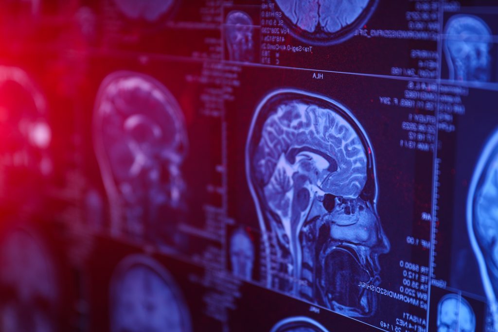 cerebro y estudios